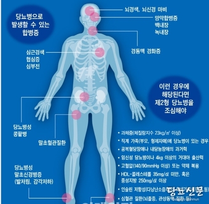 뇌경색 환자, 당뇨병 오래 앓을수록 치매발생 가능성 높아(치매와 당뇨병)