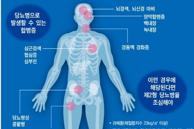 뇌경색 환자, 당뇨병 오래 앓을수록 치매발생 가능성 높아(치매와 당뇨병)